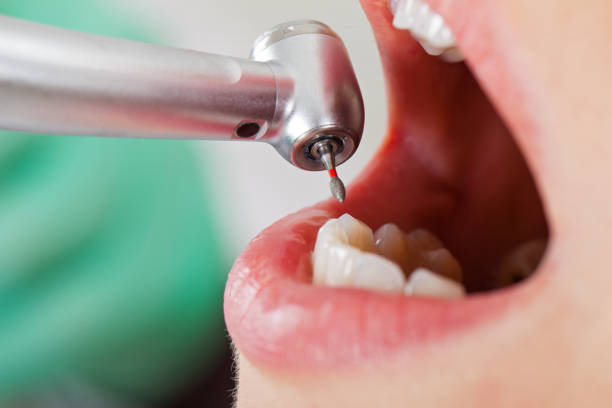 Best Emergency Dentist for Lost Fillings or Crowns in Commerce, OK